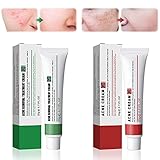 Miioto Pigmentflecken Creme 20g+Anti Pickel Creme 20g, Anti-Akne Anti-Pigmentierungscreme 2 in 1 Set für Dark Spot Remover, Akne Entfernen