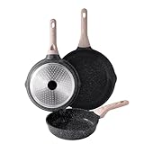 Kordisen 3-teiliges Antihaft Bratpfannen-Set 20/24/28 cm, Granit Beschichtung Induktion Pfanne, Gesund und Ungiftig, PFOA Frei