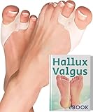 YOGAMEDIC® Hallux Valgus Korrektur und Zehenspreizer Hallux Valgus Verstellbare Gel Hallux Schiene zum Spreizen und Dehnen - 6 Stk - Silikon Zehenspreizer Kissen in Universalgröße - 0% BPA - Unisex