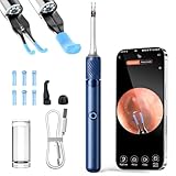 Ohrenschmalz Entferner Otoskop, VITCOCO 1080P Ohrenreiniger, Wi-Fi Ohren Reinigung, Wasserdicht Ohrreiniger, 3.2mm Ohrreiniger mit Pinzette, für Erwachsene, Kinder und Haustier