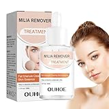 Entfernung Von Milien - 30 Ml Milia Removal Essence Under Eye Hilft Beim Auflösen Und Reduzieren Von Milia Um Die Augen, Feuchtigkeitsspendender Milia-Entferner Fettgranulat Reparatur