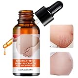 30ml Mama Schwangerschaftsöl,Hautpflege Schwangerschaft Körperöl,Massageöl zur Dehnungsstreifen Vorbeugung,MassageÖl für Schwangere,Öl gegen Dehnungsstreifen Schwangerschaft für Bauch