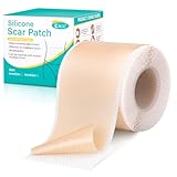 Silikon Narbenpflaster 150cm wiederverwendbar - Medizinisches Silicone Scar Sheets für Kaiserschnittnarben & Keloid, hautverträglich, atmungsaktiv, wasserdicht
