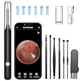 Ohrenschmalz Entferner Otoskop, LMECHN 1080P HD-Otoskop, Wifi Ohrreiniger mit kamera, Otoskop mit 6 LEDs, IP67 Wasserdicht Otoskop Ohr, für iPhone, Android, iPad, Schwarz