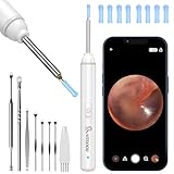 Ohrenschmalz Entferner Otoskop, VITCOCO 1920P Wifi Ohrreiniger, Ohrenreiniger mit Kamera, Otoskop mit 6 LEDs für iPhone, iPad und Android-Smartphones, Weiß