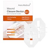 Wundverschlussstreifen 2 Stücke Wundverschluss Streifen Wundverschlüsse Strips Wundnahtstreifen Wundverschluss Pflaster Verband 6x7cm