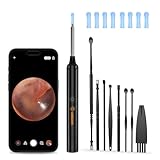 Ohrenschmalz Entferner Otoskop, LMECHN 1080P HD ohrenreiniger, Ohrreiniger mit 6 LEDs, Reinigung für iPhone, Android, iPad, Schwarz