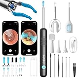 BEBIRD R1 Ultra Ohrenschmalz Entferner Kamera, Ohrenreiniger mit Otoskop für Zuhause, Komplett-Set mit Sichtbarer Dropper & Pinzette, Für Ohr & Nase & Rachen Untersuchung der Familie-Schwarze