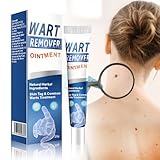 20g Warzen Entfernen Geeignet zur Warzenentfernung Entfernt Warzen und Dornwarzen, Warzenentfernungscreme Gegen Warzen Entfernung Von Dornwarzen Am Fuß & Hand und Skin Tag Remover