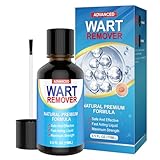 Aisisree Warzen Tinktur-Dornwarzen-Ex Entfernung von Dornwarzen am Fuß & Hand, Warzenmittel, Warzen entfernen-15ml